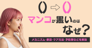 マンコが黒いのはなぜ？メカニズム・原因・ケア方法・予防策などを解説